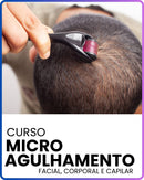 MICROAGULHAMENTO