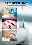 DRY NEEDLING + TERMOGRAFIA + ELETROESTIMULAÇÃO